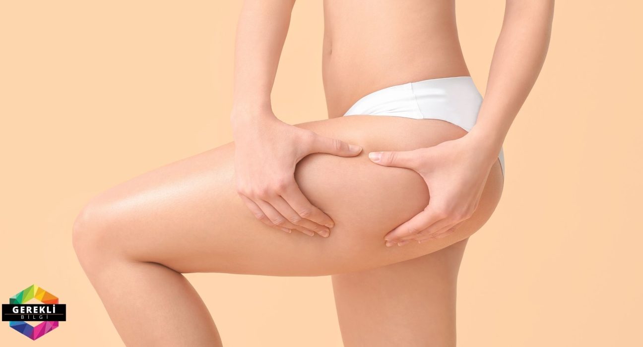 Bacaklardaki Selülit